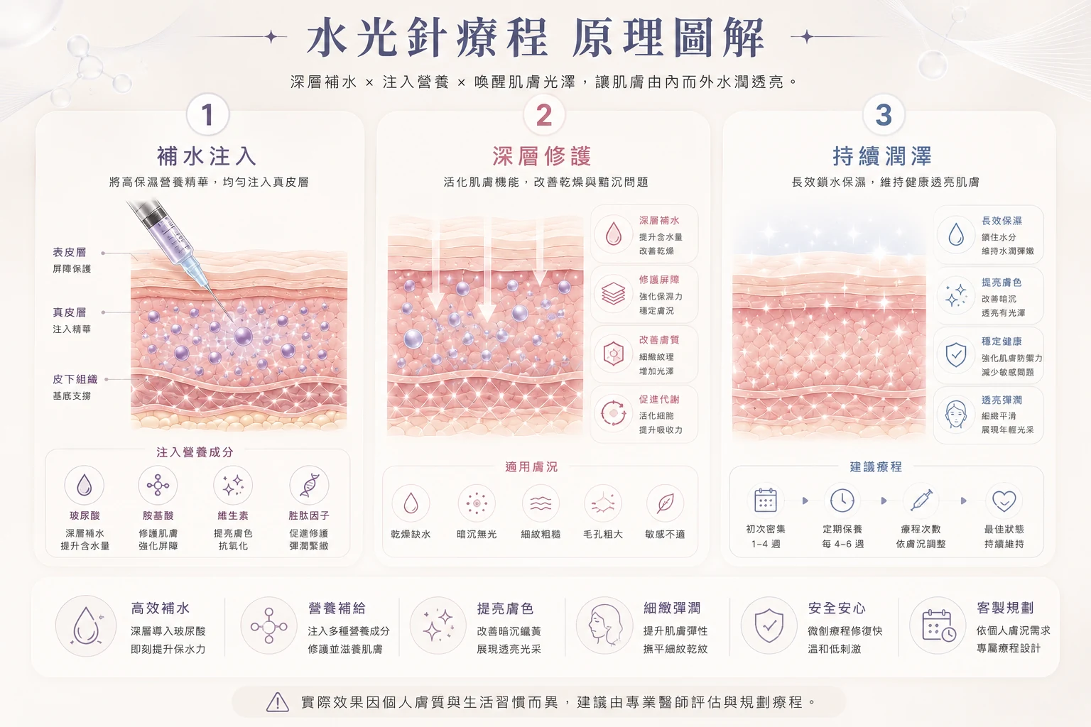 水光針原理圖